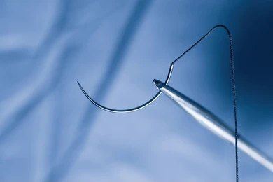 Surgical Sutures — Assorted